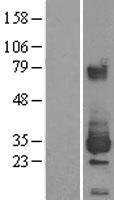 ETHE1 Human Over-expression Lysate