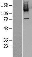 PLK4 Human Over-expression Lysate