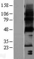 PTPLA (HACD1) Human Over-expression Lysate