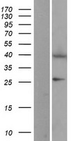 EIF2B2 Human Over-expression Lysate