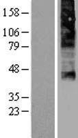 FLVCR (FLVCR1) Human Over-expression Lysate