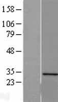 SERTAD1 Human Over-expression Lysate
