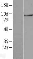 Apc2 (ANAPC2) Human Over-expression Lysate