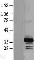 PYCR2 Human Over-expression Lysate