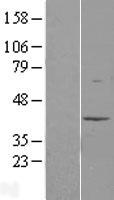 MAT2B Human Over-expression Lysate