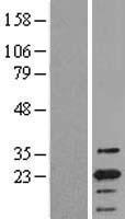 TMS1 (PYCARD) Human Over-expression Lysate