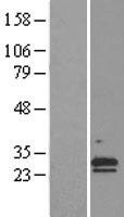 NNT1 (CLCF1) Human Over-expression Lysate