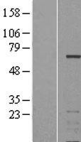 IKZF3 Human Over-expression Lysate