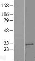 UCK2 Human Over-expression Lysate