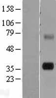 TPSG1 Human Over-expression Lysate