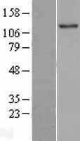 TLL2 Human Over-expression Lysate