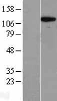 RPS6KC1 Human Over-expression Lysate