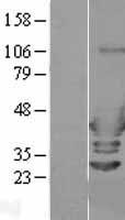 ARFIP2 Human Over-expression Lysate