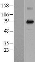 PADI4 Human Over-expression Lysate