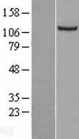 NNT Human Over-expression Lysate