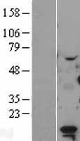 LDOC1 Human Over-expression Lysate