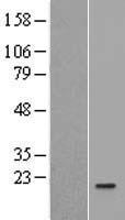 IL36RN Human Over-expression Lysate