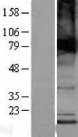 TMEM184B Human Over-expression Lysate