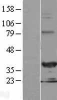 HEY2 Human Over-expression Lysate