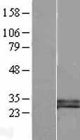 DKK1 Human Over-expression Lysate