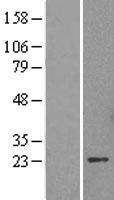 HP1 alpha (CBX5) Human Over-expression Lysate