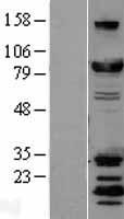 DRP1 (DNM1L) Human Over-expression Lysate