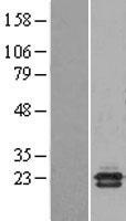 NCBP2 Human Over-expression Lysate