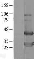TWF2 Human Over-expression Lysate