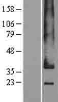 GPR182 Human Over-expression Lysate