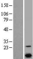 Calcium binding protein P22 (CHP1) Human Over-expression Lysate