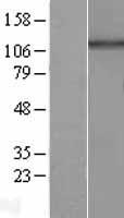 HPS5 Human Over-expression Lysate