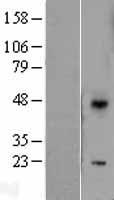 DUSP10 Human Over-expression Lysate