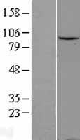 Gemin 3 (DDX20) Human Over-expression Lysate