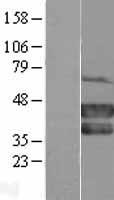 Mel18 (PCGF2) Human Over-expression Lysate