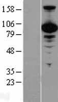 VCP Human Over-expression Lysate