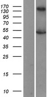 LXR beta (NR1H2) Human Over-expression Lysate