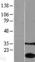Acid Phosphatase (ACP1) Human Over-expression Lysate