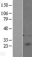 CD160 Human Over-expression Lysate