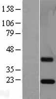 ESM1 Human Over-expression Lysate