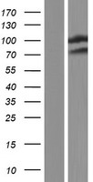 WWP2 Human Over-expression Lysate