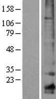 Claudin 10 (CLDN10) Human Over-expression Lysate