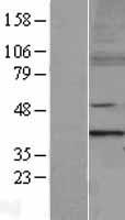 MTERF (MTERF1) Human Over-expression Lysate