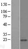 CALM1 Human Over-expression Lysate