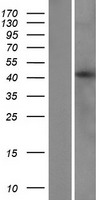 LIAS Human Over-expression Lysate