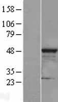 HEAB (CLP1) Human Over-expression Lysate