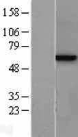 Methionine Aminopeptidase 2 (METAP2) Human Over-expression Lysate
