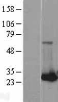 RAB32 Human Over-expression Lysate