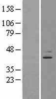 EBNA1 binding protein 2 (EBNA1BP2) Human Over-expression Lysate