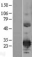 ERP29 Human Over-expression Lysate