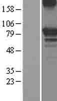 OS9 Human Over-expression Lysate
